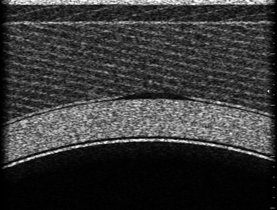 Image d’échographie simulée